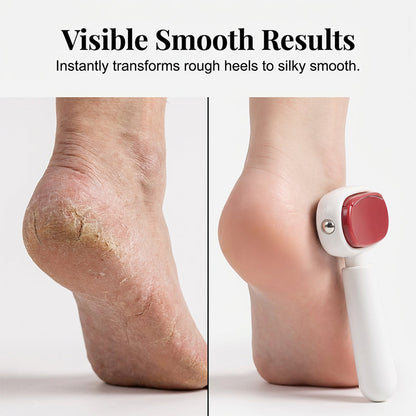 🦶 Dual-Sided Foot File – Smooth & Soft Feet at Home
